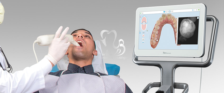 ایمپلنت دیجیتال برای دندان