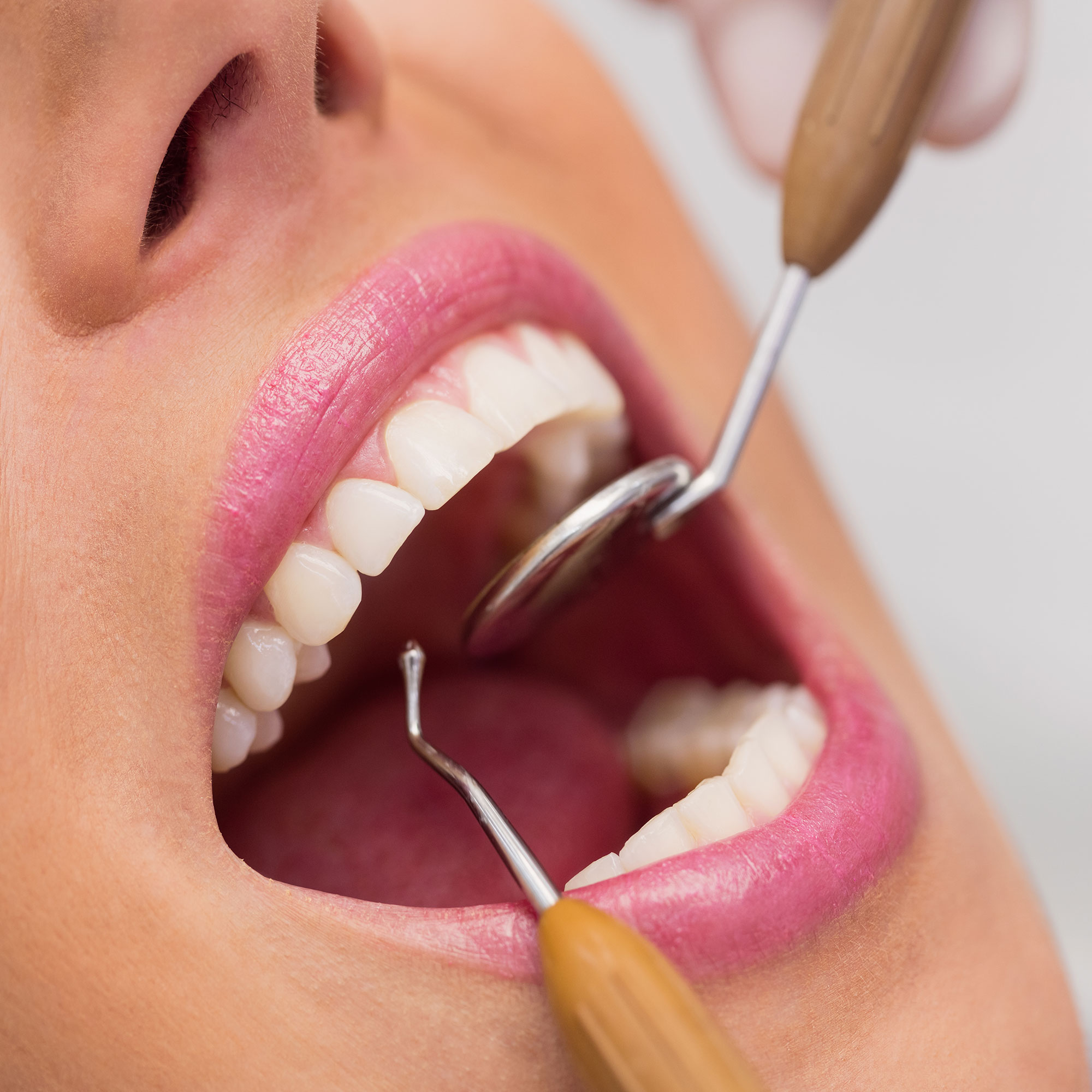 درمان ریشه و عصب کشی دندان