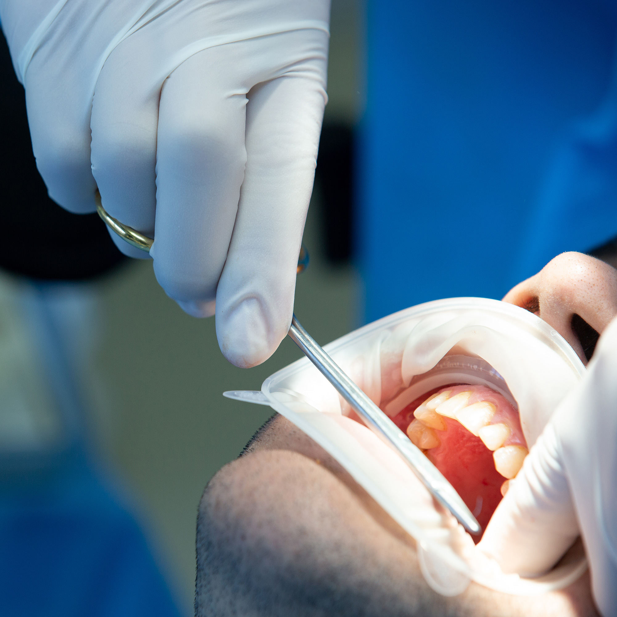 جراحی دندان در تهران