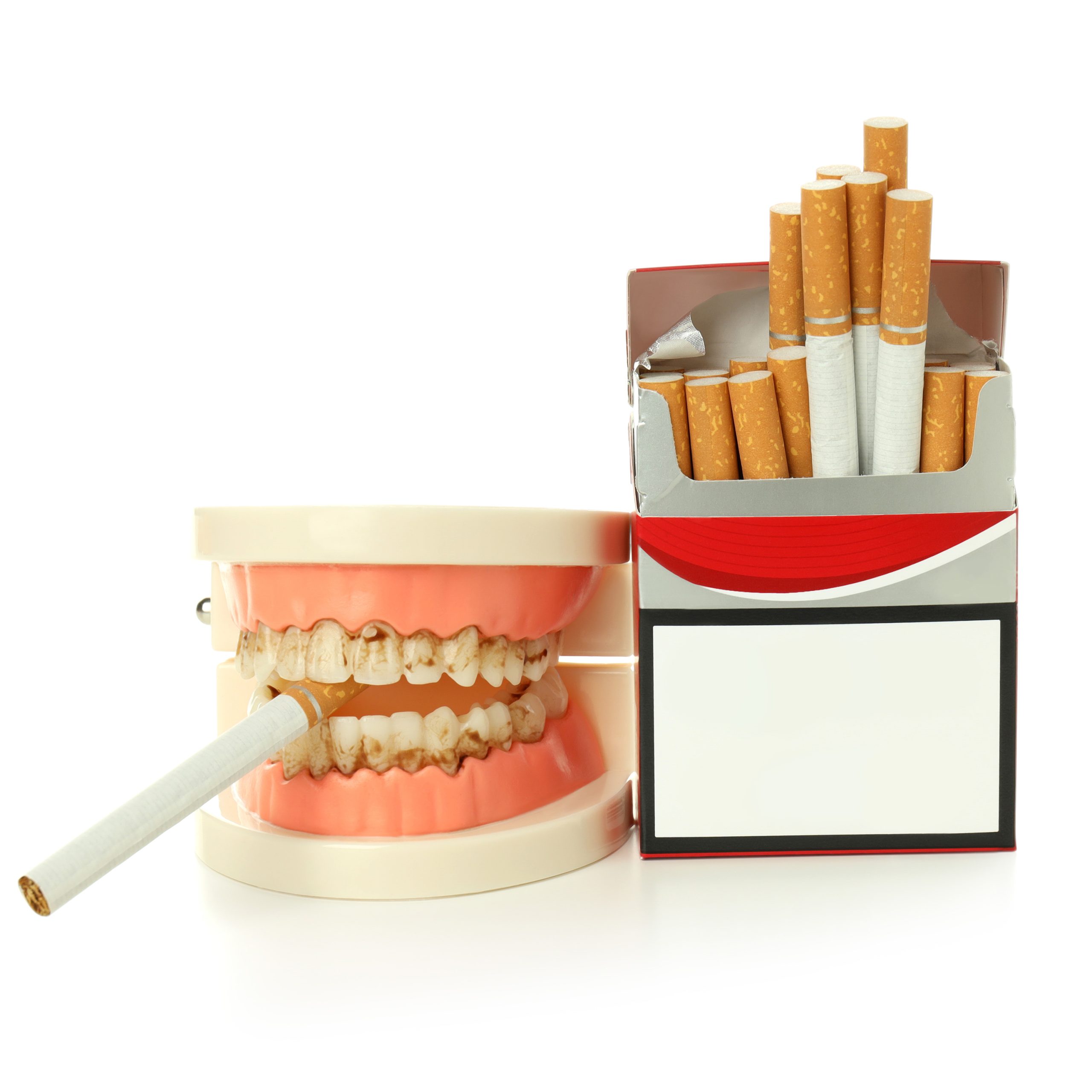تاثیر سیگار بر سلامت دهان و دندان