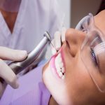 فیلینگ دندان توسط دندانپزشک